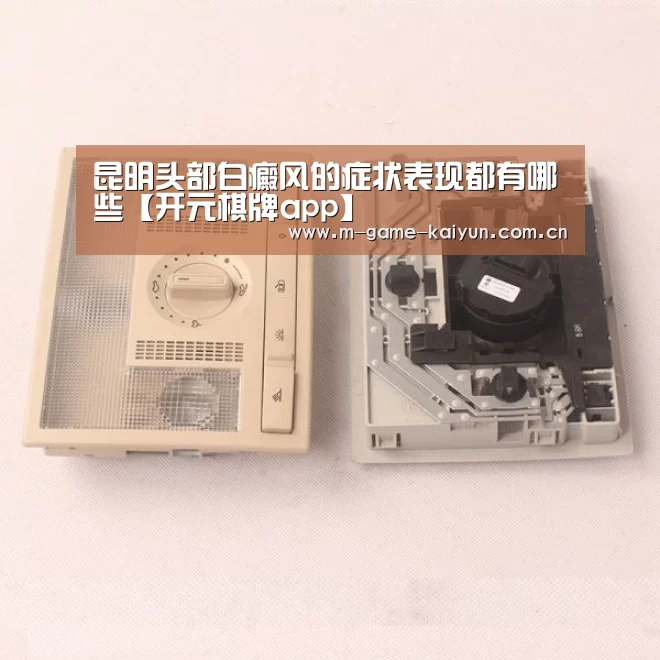 昆明头部白癜风的症状表现都有哪些【开元棋牌app】(图2) 开云首页